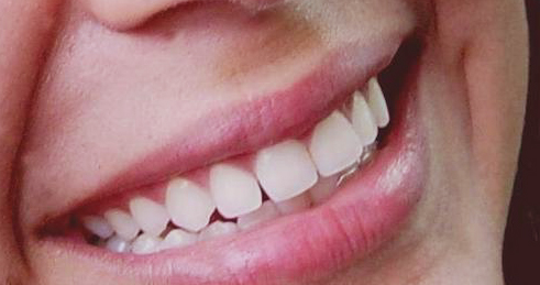 dientes